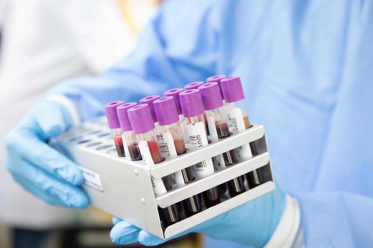 In Vitro Diagnostic Industry in China - Blood Typing Instruments and Reagents VI